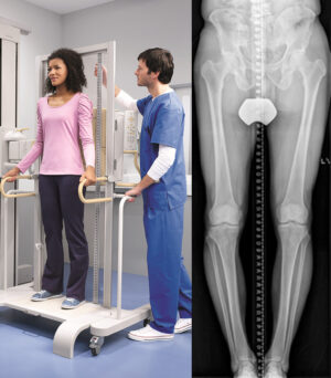 Цифровая рентгенографическая система Philips Digital Diagnost
