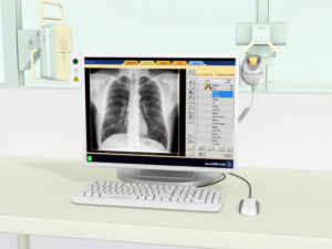 Цифровая рентгенографическая система Philips Flexi Diagnost