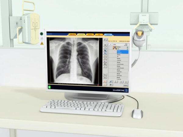 Цифровая рентгенографическая система Philips Flexi Diagnost