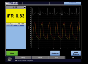 Philips Volcano Core Mobile